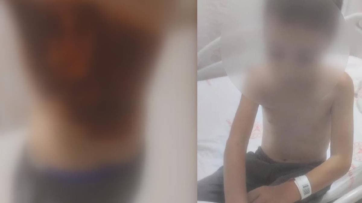 Arnavutköy’de 12 yaşındaki çocuk nasıl ağır yaralandı?