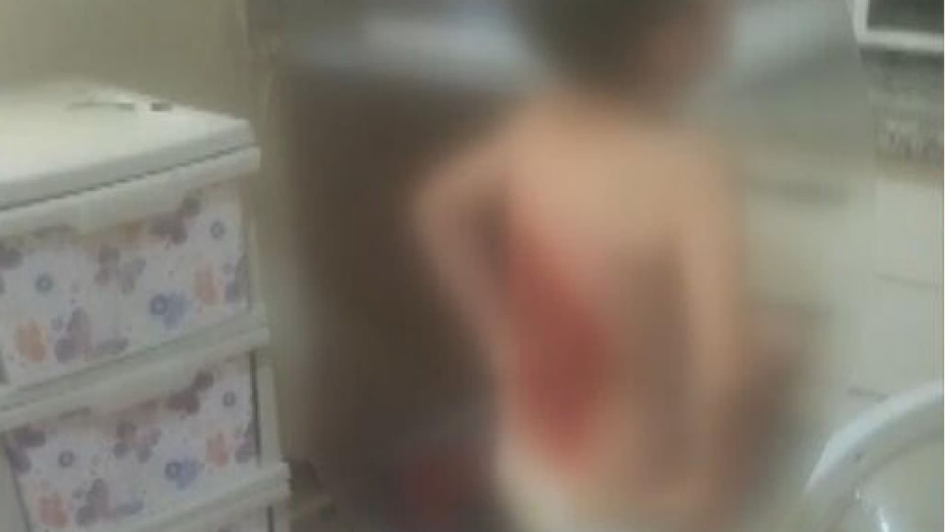 Arnavutköy’de 12 yaşındaki çocuk nasıl yaralandı?