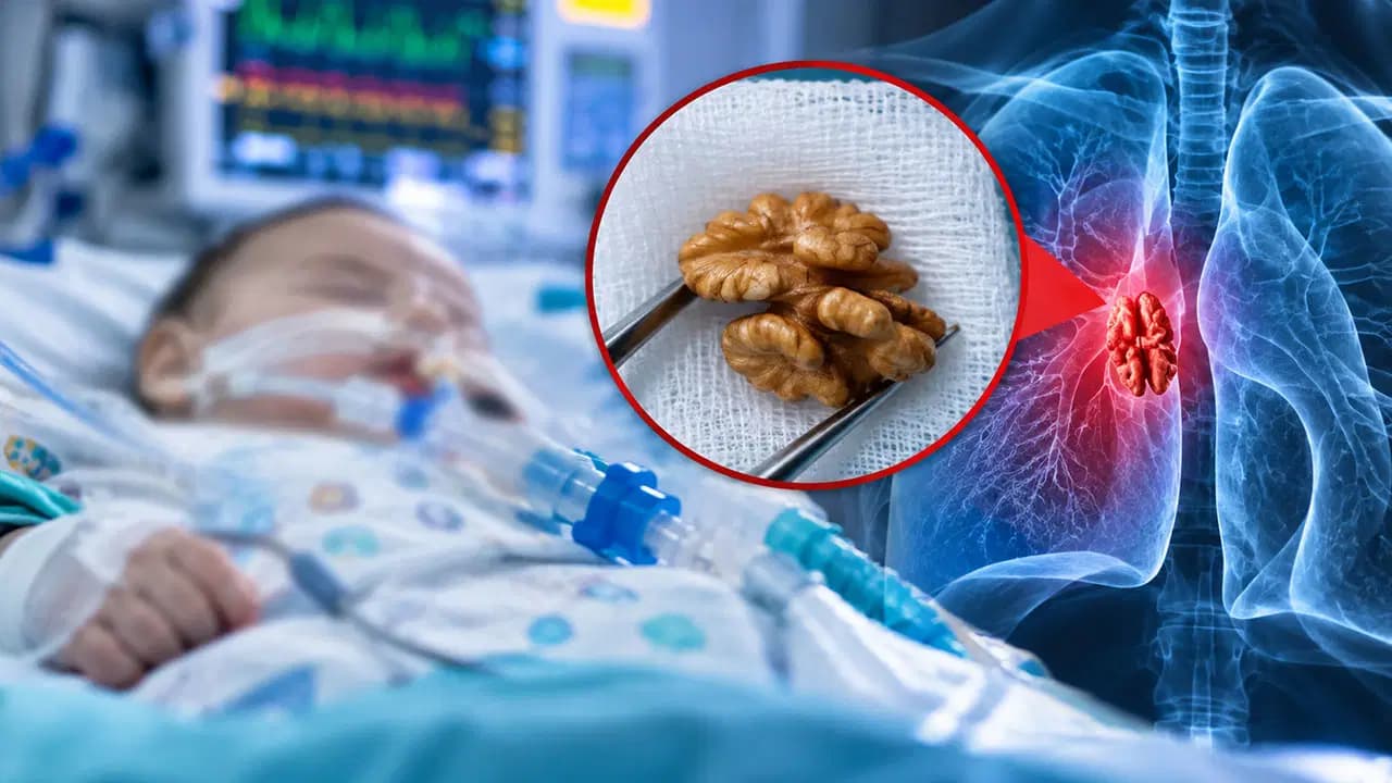 Doğum günü sonrası ölümden döndü: 1 yaşındaki bebeğin akciğerinden ceviz çıktı!