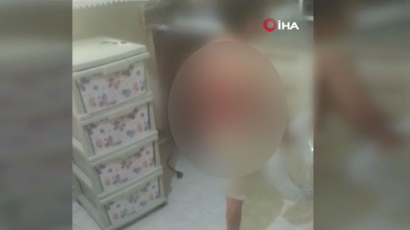 Arnavutköy’de 12 yaşındaki çocuk kolonya dökülerek mi yakıldı?