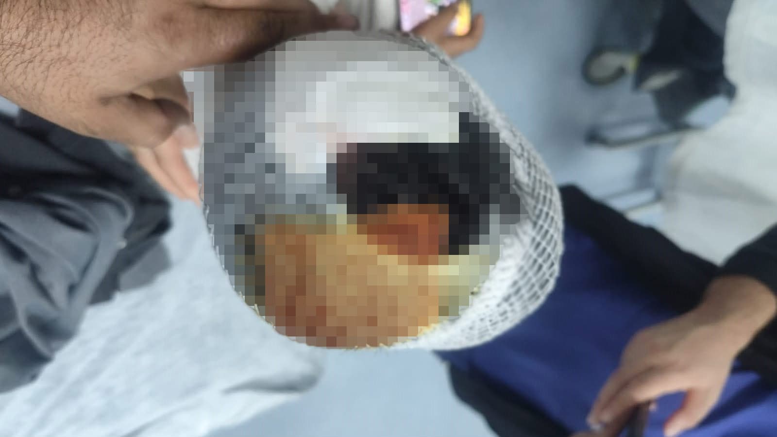 Viranşehir’de köpek saldırısına uğrayan çocuğun başına 15 dikiş atıldı